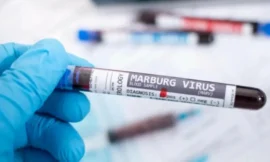 السفارة السعودية في إثيوبيا تحذر من انتشار فايروس ماربورغ